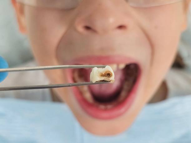 Best Weekend Emergency Dentist in Hooks, TX