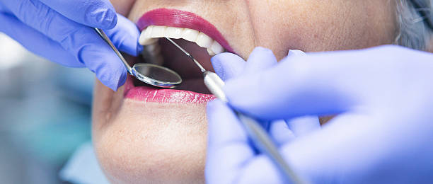 Best Emergency Gum Treatment in Hooks, TX